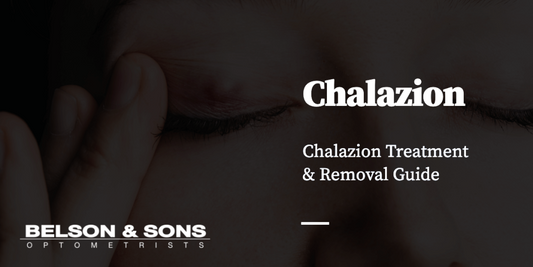 Chalazion Treatment & Removal Guide
