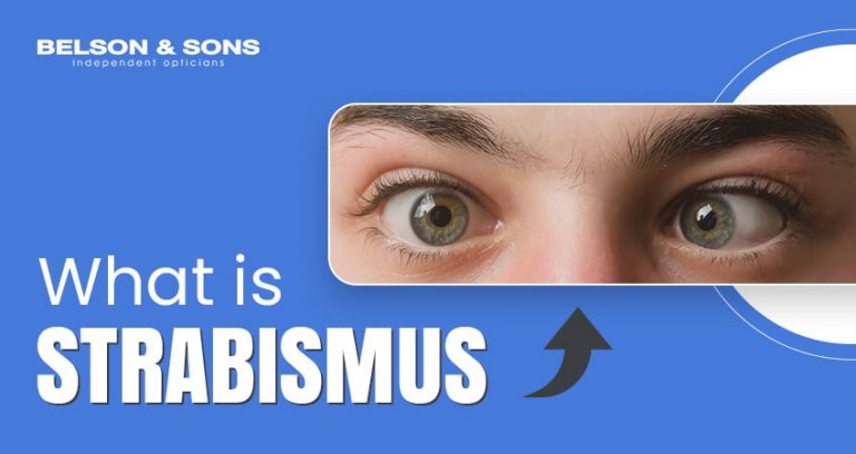 What Is Strabismus/Squint? Causes and Types - Belson Opticians