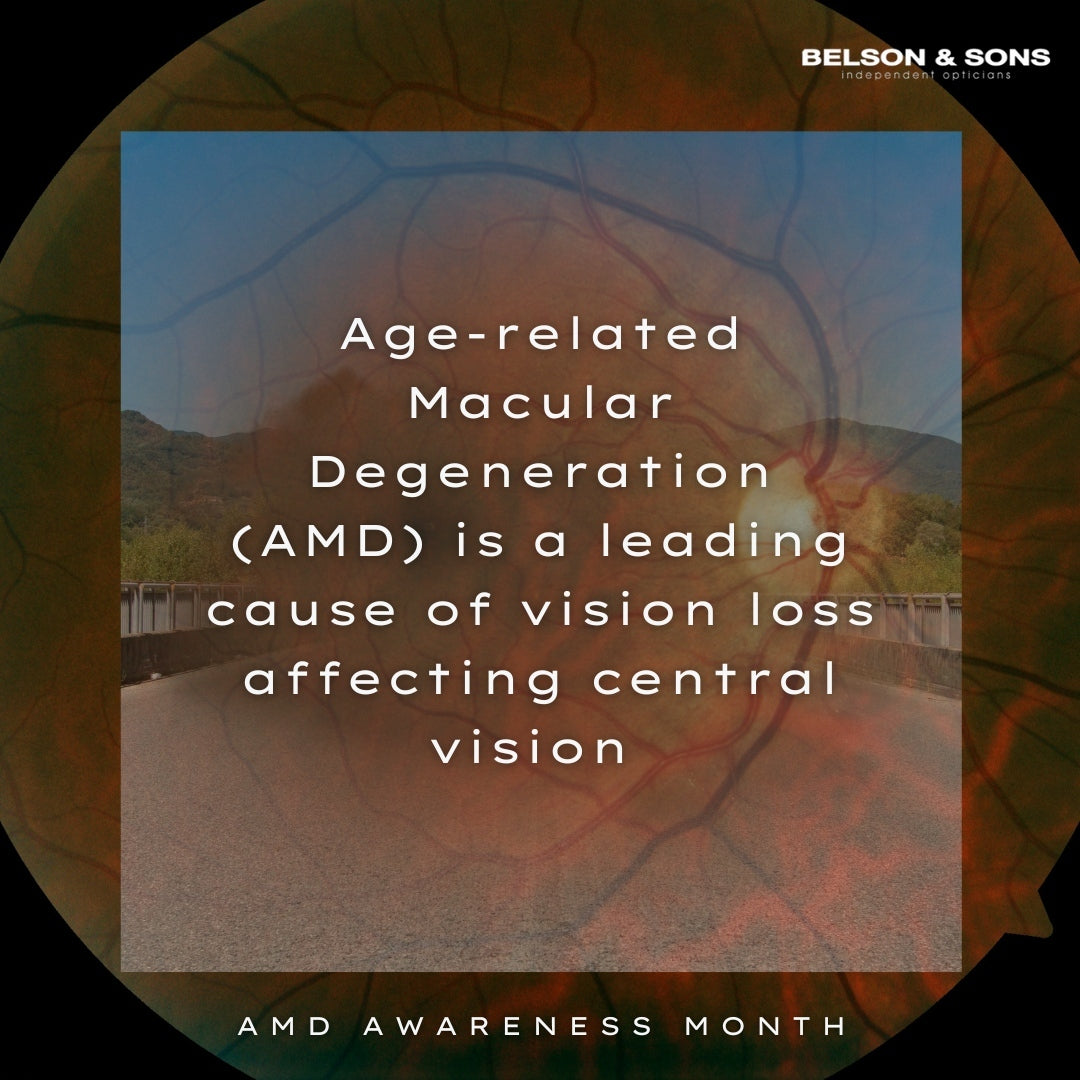 Protecting Your Vision: Understanding AMD and the Importance of Regular Eye Exams with Belson & Son Opticians