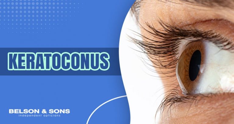 Eye Condition Keratoconus: Causes, Symptoms and Treatments - Belson Opticians