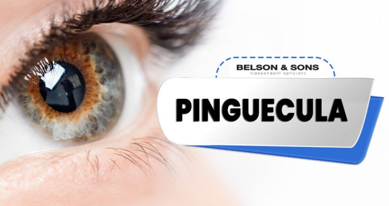 Pinguecula: Symptoms, Causes & Treatment - Belson Opticians