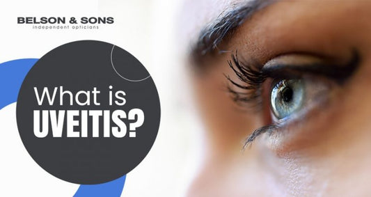 Uveitis – Causes, Symptoms & Treatment - Belson Opticians